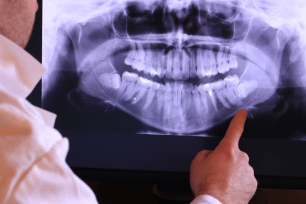 Best Emergency Root Canal Treatment in Drumright, OK