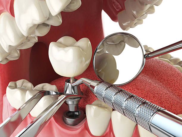 Best Emergency Dentist for Lost Fillings or Crowns in Drumright, OK